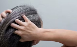 অকালে চুল পাকার কারণ ও প্রতিকার জানুন