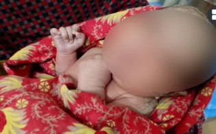 মা হলেন চতুর্থ শ্রেণির সেই শিশুটি