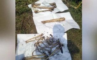 এমপি আনারের হাড়গোড় উদ্ধার