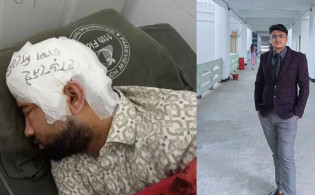 মাথার খুলিতে 'হাড় নেই' চাপ দিবেন না'