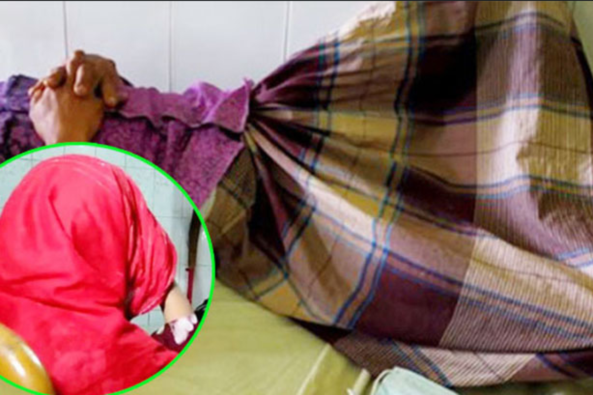 যে কারণে বাসর রাতে স্বামীর গোপনাঙ্গ কাটলে নববধূ