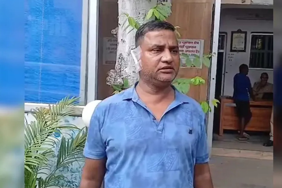 স্বামীর কান কামড়ে ছিঁড়ে নিলেন স্ত্রী