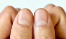 নখের গোড়ার সাদা অর্ধচাঁদ আপনার স্বাস্থ্যের সংকেত দিতে পারে