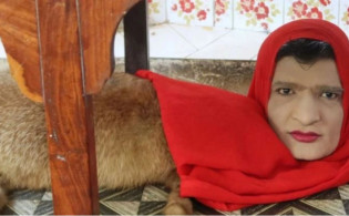 চিড়িয়াখানায় দেখা মিললো অর্ধেক মানুষ, অর্ধেক শেয়াল! 