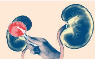 যে পেশাগুলো কিডনি সমস্যার ঝুঁকি বাড়ায়