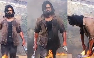 এবার আগুনে দগ্ধ হলেন আরিফিন শুভ