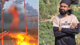 আগুনে পুড়লেন কনটেন্ট ক্রিয়েটর, যা জানালেন চিকিৎসকরা