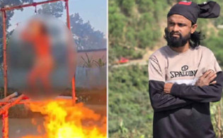 আগুনে পুড়লেন কনটেন্ট ক্রিয়েটর, যা জানালেন চিকিৎসকরা