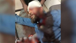 খুলনায় প্রকাশ্যে এনসিপি নেতারমাথায়গু-লি