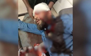 খুলনায় প্রকাশ্যে এনসিপি নেতার মাথায় গু-লি