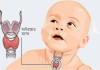 যেসব কারণে থাইরয়েড রোগে ভোগে শিশু