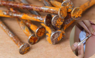 মরিচা নয়, আসল ভয় অন্য কিছু! জানুন টিটেনাসের কারণ