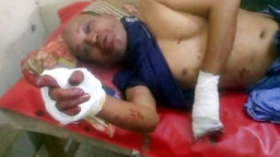 মেয়ে হাত-পা চেপে ধরেন, বুকের ওপর বসে স্ত্রী, ছুরি চালান ছেলে