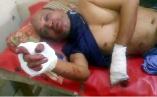 মেয়ে হাত-পা চেপে ধরেন, বুকের ওপর বসে স্ত্রী, ছুরি চালান ছেলে