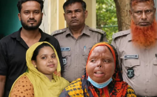 গরম ডাল ছুড়ে স্ত্রীর মুখ ঝলসে দিলেন, পরে দিলেন তালাক